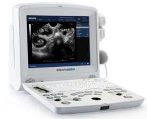 Edan Sistema de ultrasonido de diagnóstico DUS 60 VET